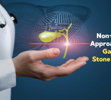 Non-Surgical Approaches for Gallbladder Stone Removal